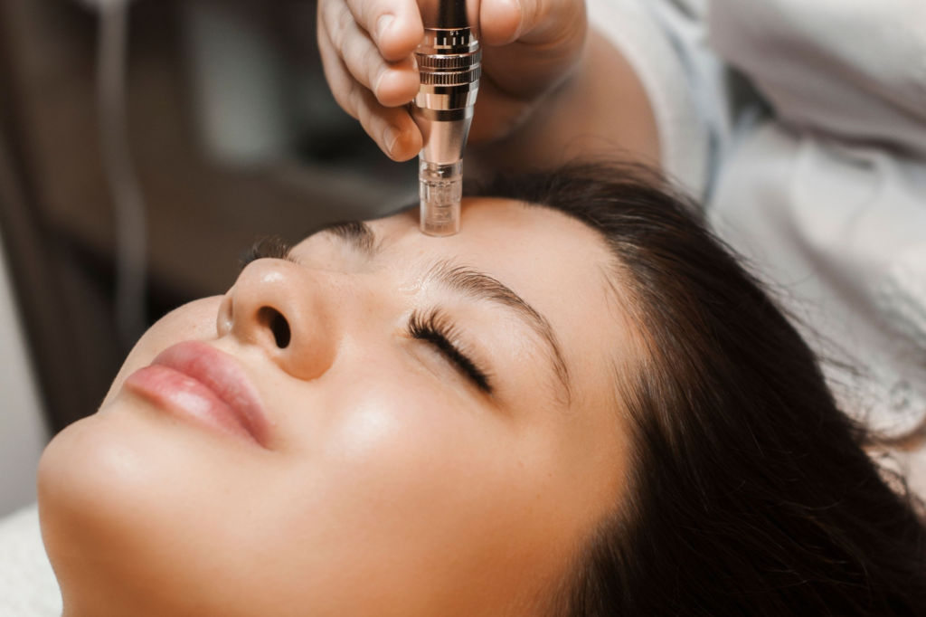 How To Get Ultimate Results With Dermapen Micro Needling