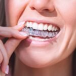 Invisalign in Waltham Cross