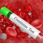 Creatinine Test